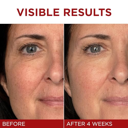 Revitalift 2 L'Oreal Paris Revitalift Triple Power Anti-Aging Face Moisturizer, Pro Retinol, Hyaluronic Acid & Vitamin C to Reduce Wrinkles, Firm & Brighten Skin, 1.7 Oz