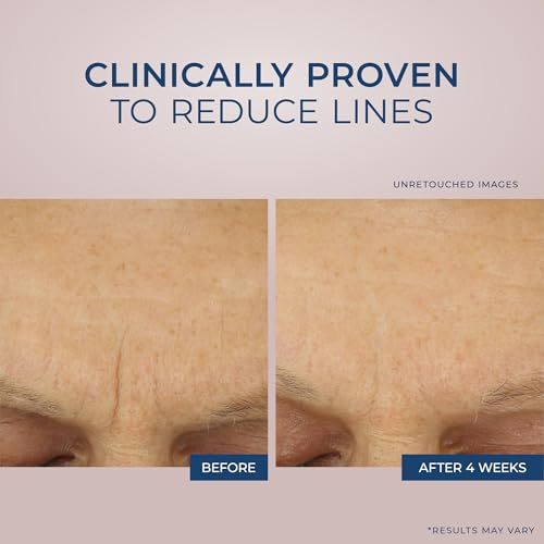 Retinol Correxion 3 RoC Retinol Correxion Max Daily Hydration Anti-Aging Face Moisturizer with Hyaluronic Acid, Oil Free Skin Care Cream for Fine Lines, Dark Spots, Post-Acne Scars, 1.7 Ounces...