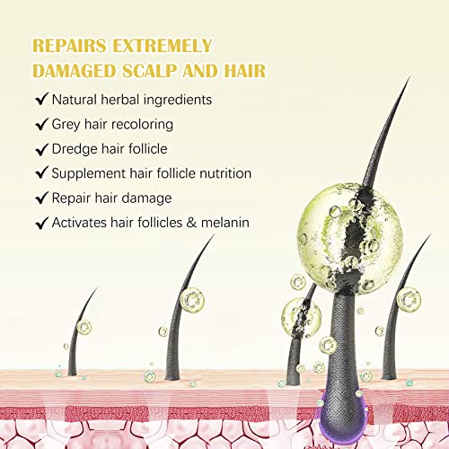 5% Minoxidil 5 5% Minoxidil Hair Growth Oil for Men and Women - Regrowth Serum, Extra Strength Spray for Hair Loss, Thicker Healthier Hair, Beard Growth Kit, Topical Treatment, 2.02 oz