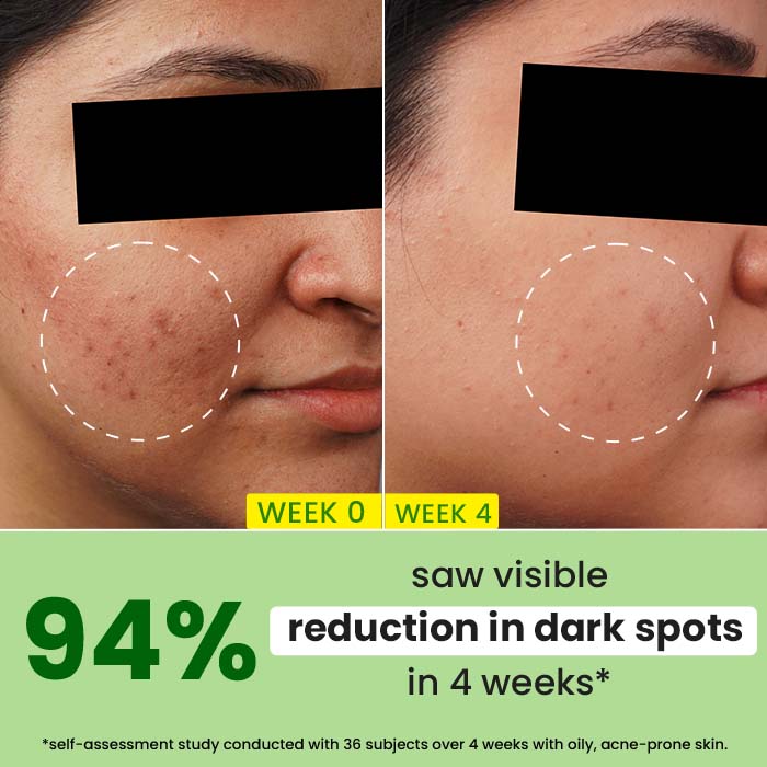 Cica + 10% Niacinamide Face Serum for Oily Skin 3 Cica + 10% Niacinamide Face Serum for Oily Skin
