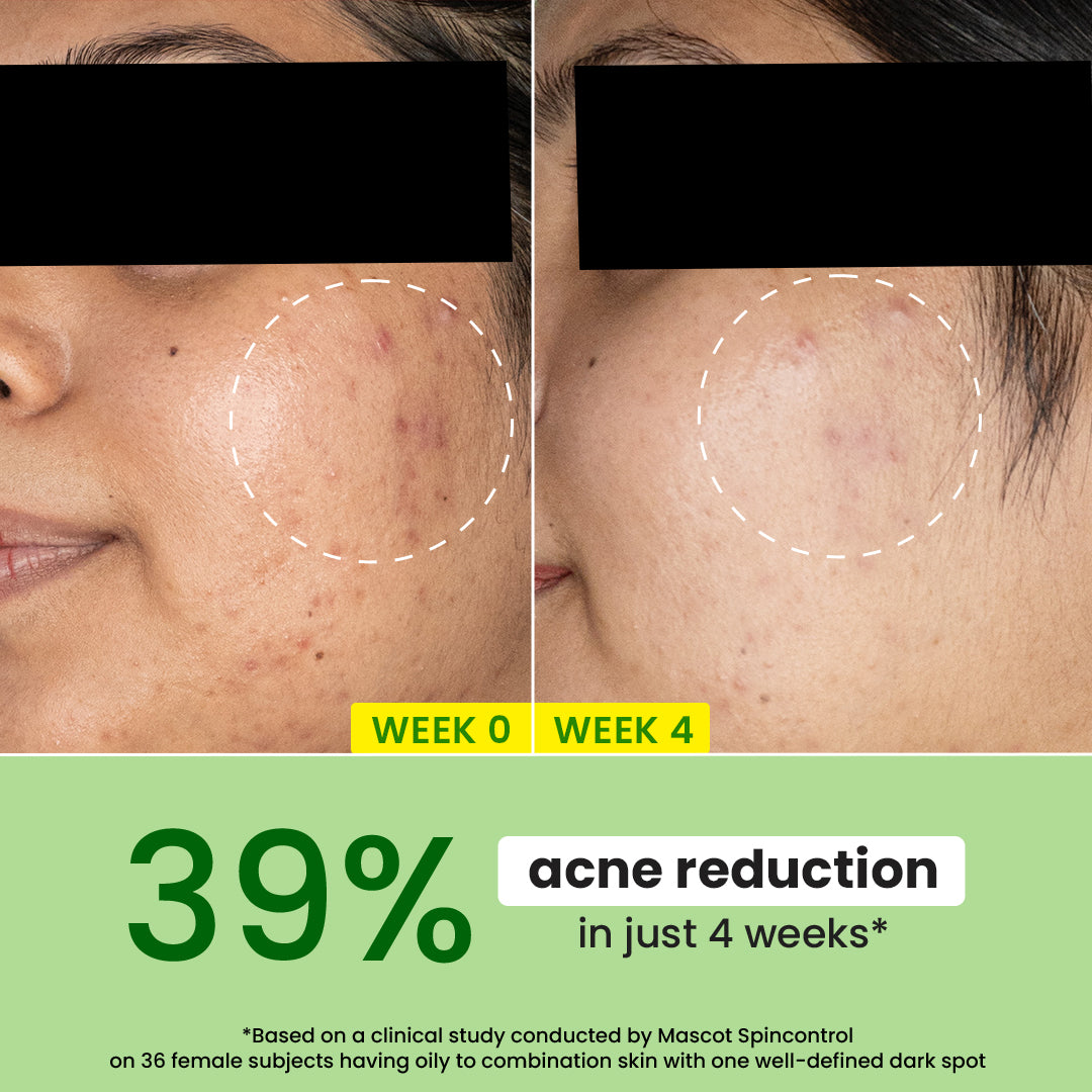 Cica & Niacinamide Night Gel for Oily & Acne Prone Skin 3 Cica & Niacinamide Night Gel for Oily & Acne Prone Skin