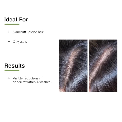Fixderma Kairfoll Anti Dandruff Shampoo for Oily Sensitive Scalp Prone to Dandruff & Folliculitis 3 Fixderma Kairfoll Anti Dandruff Shampoo for Oily Sensitive Scalp Prone to Dandruff & Folliculitis