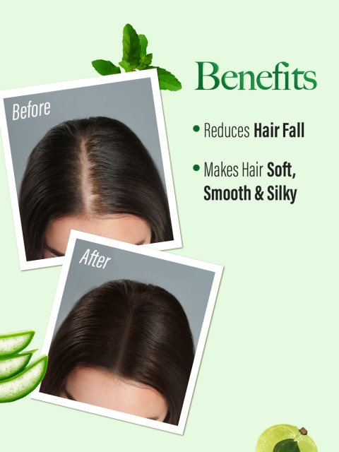 Kesh King Ayurvedic Anti-Hairfall Shampoo with Aloe & 21 Ayurvedic Herbs - 1000ml 5 Kesh King Ayurvedic Anti-Hairfall Shampoo with Aloe & 21 Ayurvedic Herbs - 1000ml