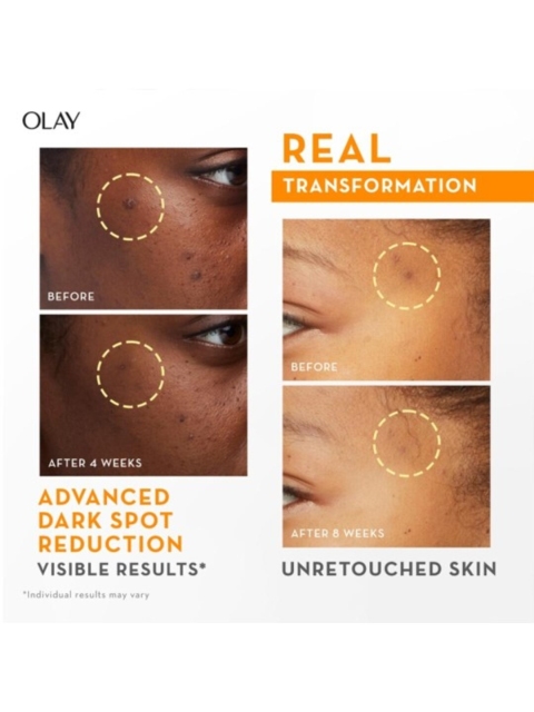 Olay Vitamin C Kit for 2X Glow with Serum 30ml & Cleanser 100g 6 Olay Vitamin C Kit for 2X Glow with Serum 30ml & Cleanser 100g