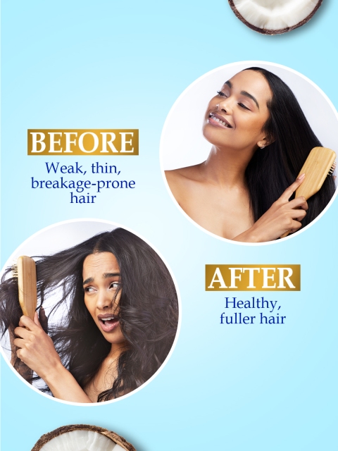 Parachute Advansed Gold Biotin Coconut Hair Oil for Fuller Hair - 300 ml 6 Parachute Advansed Gold Biotin Coconut Hair Oil for Fuller Hair - 300 ml
