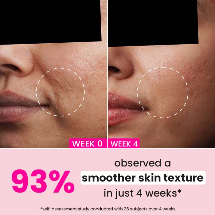 Pomegranate + 0.9% Retinol Serum for Fine Lines & Wrinkles 3 Pomegranate + 0.9% Retinol Serum for Fine Lines & Wrinkles