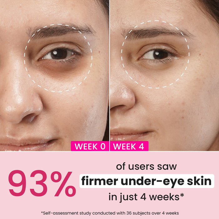 Pomegranate + Retinol Eye Cream for Fine Lines & Wrinkles 3 Pomegranate + Retinol Eye Cream for Fine Lines & Wrinkles