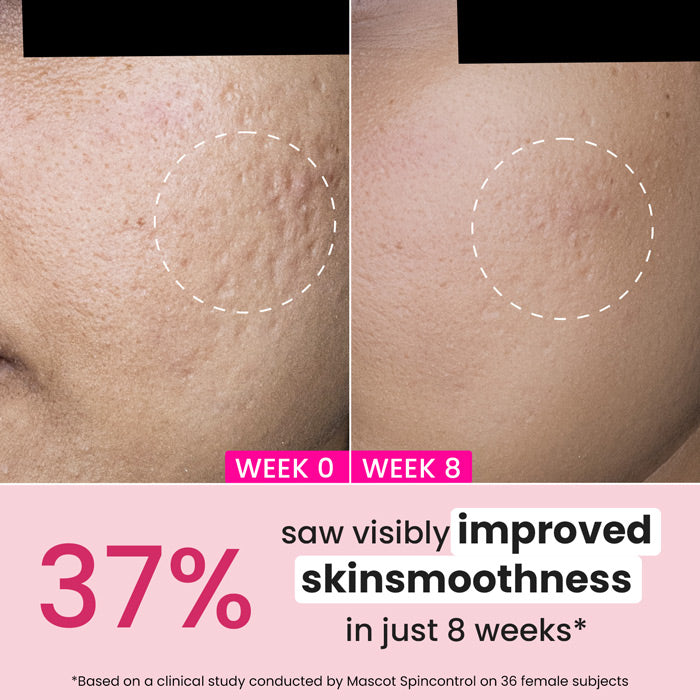 Retinol + Ceramide Night Cream for Fine Lines & Wrinkles 3 Retinol + Ceramide Night Cream for Fine Lines & Wrinkles