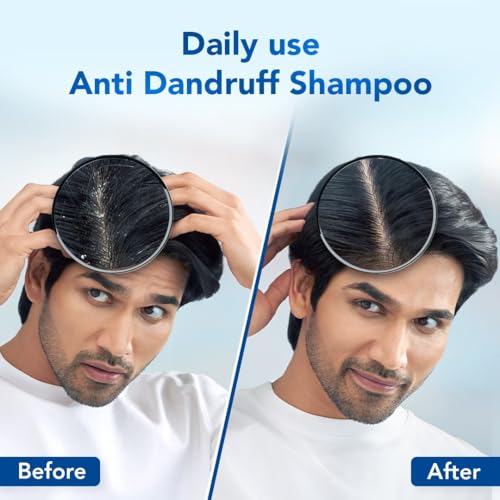 Scalpe Pro Daily Anti-Dandruff Shampoo | Removes Dandruff from Source 2 Scalpe Pro Daily Anti-Dandruff Shampoo | Removes Dandruff from Source