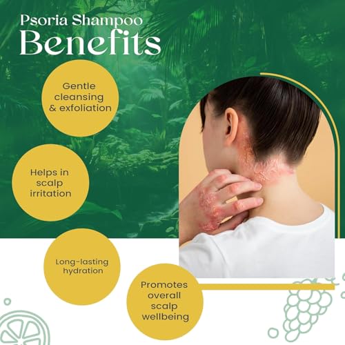 SiyaAyurveda Siya Ayurveda Psoria Shampoo-Scalp Psoriasis|Sulfate-Free Cleanser|Itchy Scalp,Anti-Dandruff Formula For Healthy Hai 5 SiyaAyurveda Siya Ayurveda Psoria Shampoo-Scalp Psoriasis|Sulfate-Free Cleanser|Itchy Scalp,Anti-Dandruff Formula For Healthy Hai