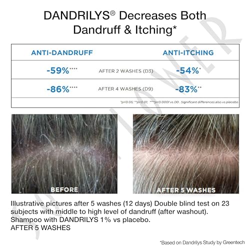 Soulflower Anti Dandruff Shampoo with Piroctone Olamine, 1% Salicylic Acid 4 Soulflower Anti Dandruff Shampoo with Piroctone Olamine, 1% Salicylic Acid