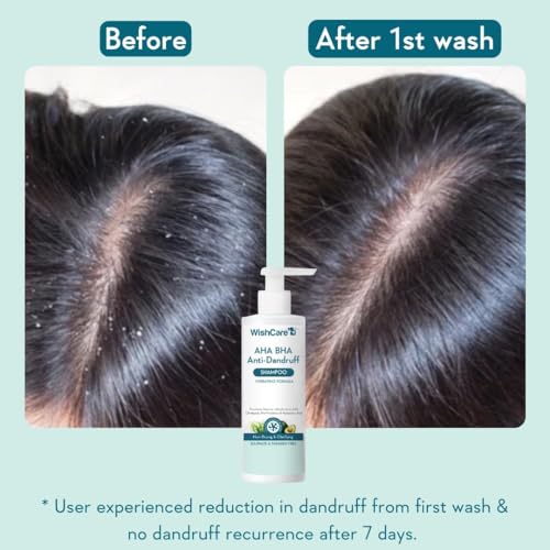 WishCare Hydrating AHA BHA Anti Dandruff Shampoo For Women & Men 2 WishCare Hydrating AHA BHA Anti Dandruff Shampoo For Women & Men