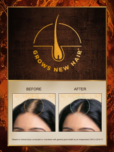 Indulekha Bringha Hair Oil 50 ml 4 Indulekha Bringha Hair Oil 50 ml