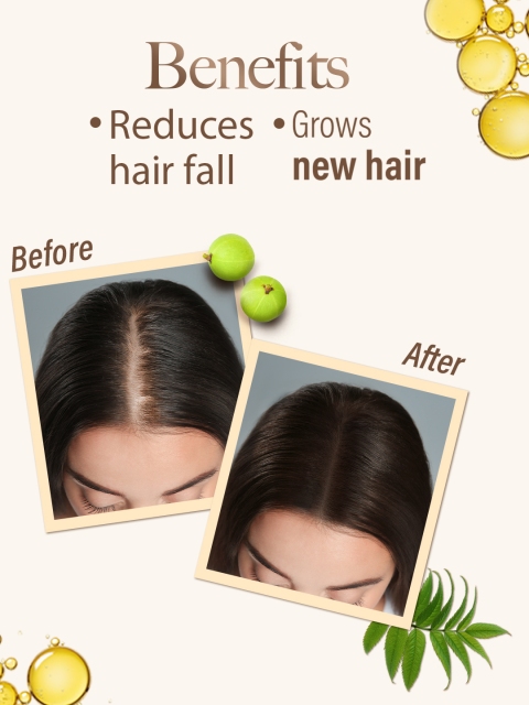 Kesh King Ayurvedic Oil with 21 Ayurvedic Herbs to Reduce Hairfall - 450 ml 5 Kesh King Ayurvedic Oil with 21 Ayurvedic Herbs to Reduce Hairfall - 450 ml