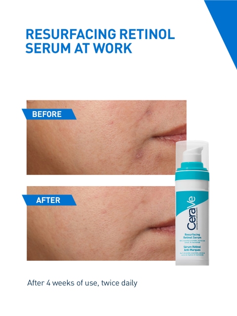 CeraVe Resurfacing Retinol Serum with Licorice Root Extract & Niacinamide - 30ml 4 CeraVe Resurfacing Retinol Serum with Licorice Root Extract & Niacinamide - 30ml