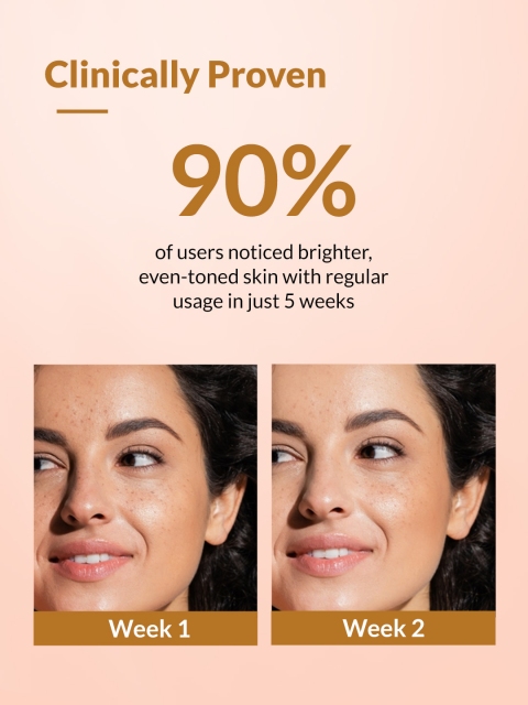 FIXDERMA Skarfix-Plus Hyperpigmentation & Acne Scars Removal Cream with Kojic Acid - 15g 5 FIXDERMA Skarfix-Plus Hyperpigmentation & Acne Scars Removal Cream with Kojic Acid - 15g