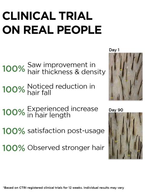 Soulflower Cold Pressed 100% Pure Castor Oil for Hair and Skin 225ml 3 Soulflower Cold Pressed 100% Pure Castor Oil for Hair and Skin 225ml