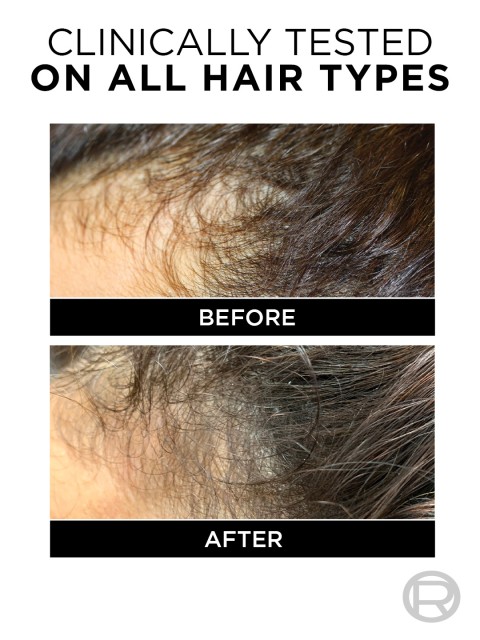LOreal Paris Fall Resist 3X Arginine Anti-Hair Fall Shampoo 340 ml 3 LOreal Paris Fall Resist 3X Arginine Anti-Hair Fall Shampoo 340 ml