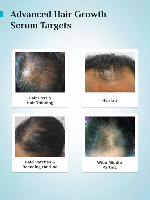 Pilgrim Advanced Hair Growth Serum Roll With 3% Redensyl - 25ml 6 Pilgrim Advanced Hair Growth Serum Roll With 3% Redensyl - 25ml